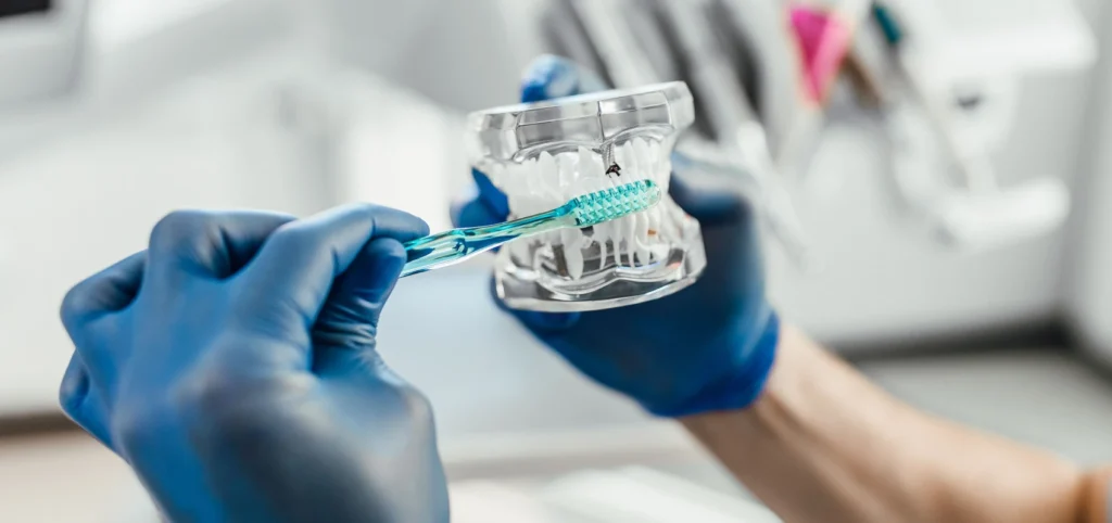 chirurgien dentiste facettes meriel Dr Ludovic Zeitoun - Chirurgien-dentiste à L’Isle-Adam