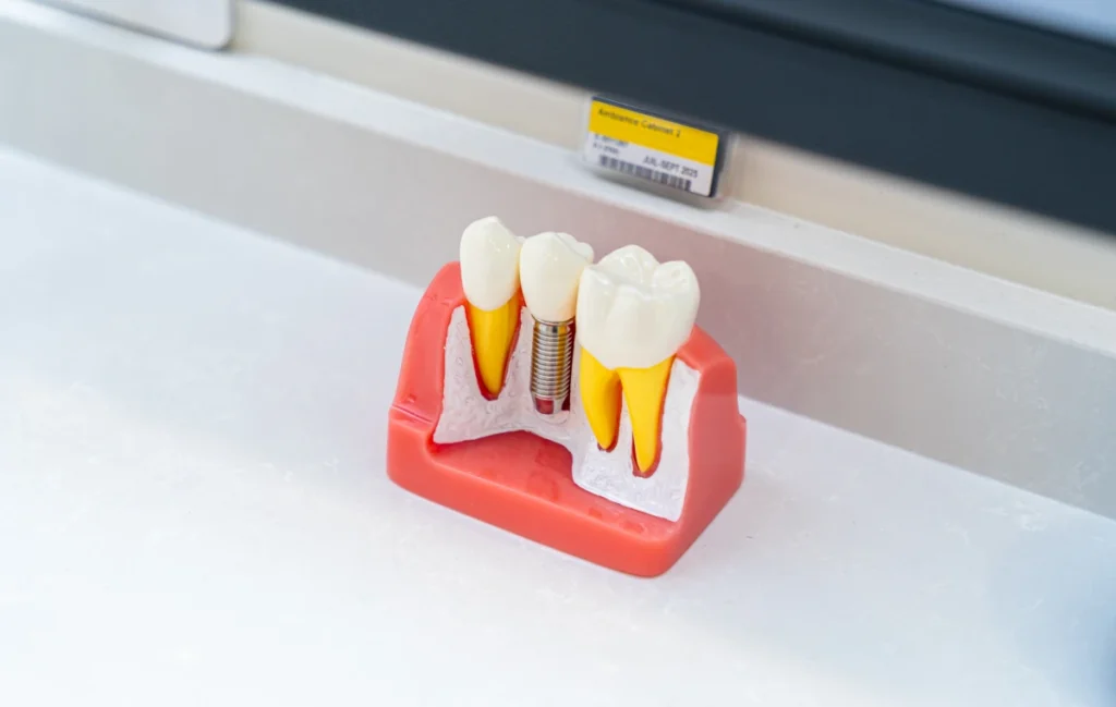 devitalisation dr ludovic zeitoun isle devitalisation dr ludovic zeitoun isle Implants dentaires Dr Ludovic Zeitoun - Chirurgien-dentiste à L'Isle-Adam