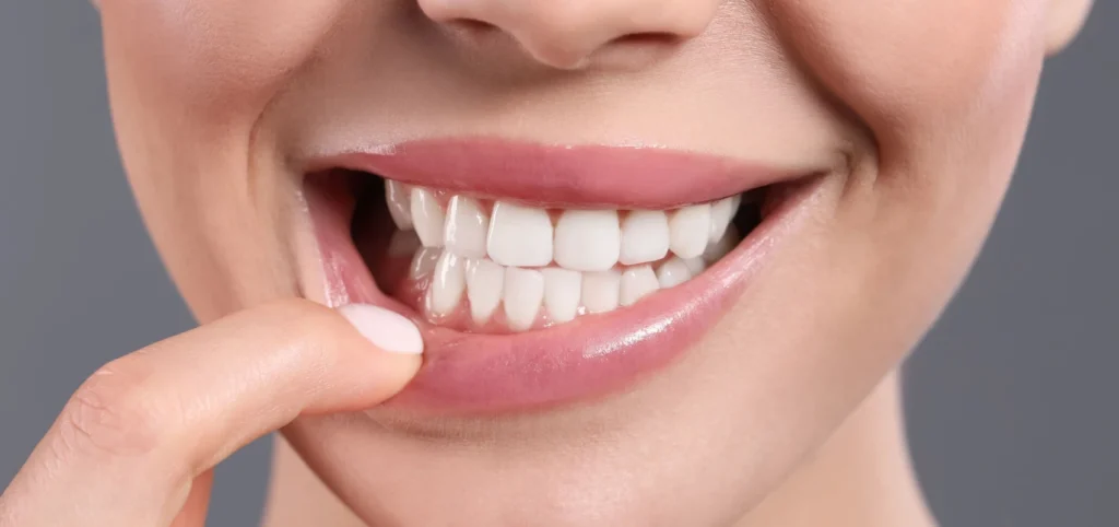 dentiste facettes dentaires l isle adam dentiste facettes dentaires l isle adam Parodontite : la maladie des gencives Dr Ludovic Zeitoun - Chirurgien-dentiste à L'Isle-Adam