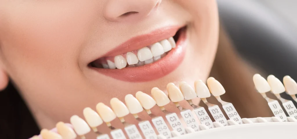 dr ludovic zeitoun implants auvers sur oise dr ludovic zeitoun implants auvers sur oise Les facettes : l’esthétique du sourire Dr Ludovic Zeitoun - Chirurgien-dentiste à L'Isle-Adam