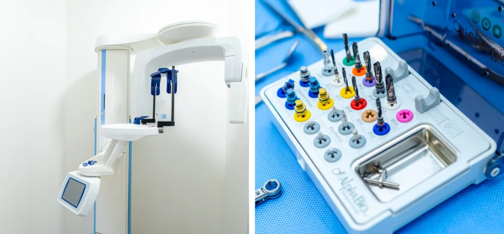 chirurgien dentiste implants l isle adam x chirurgien dentiste implants l isle adam x Soins des caries Dr Ludovic Zeitoun - Chirurgien-dentiste à L'Isle-Adam