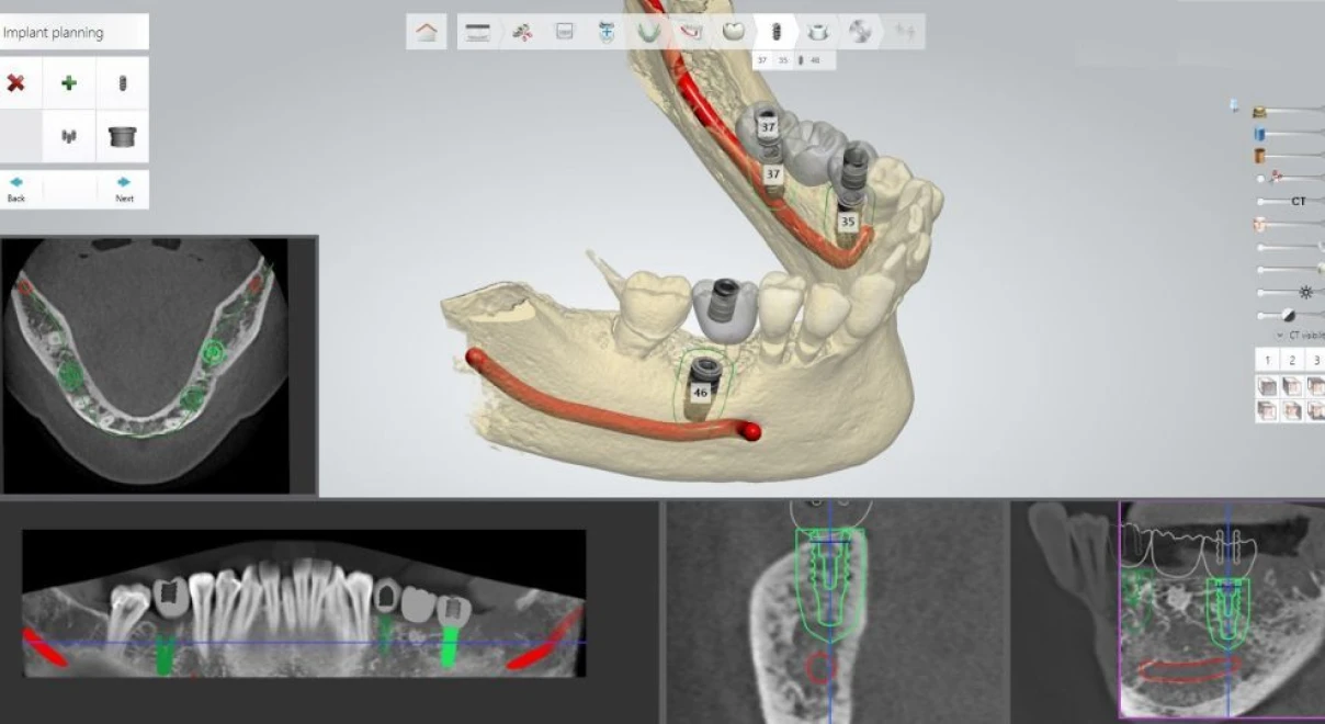 dr ludovic zeitoun reconstruction l isle adam