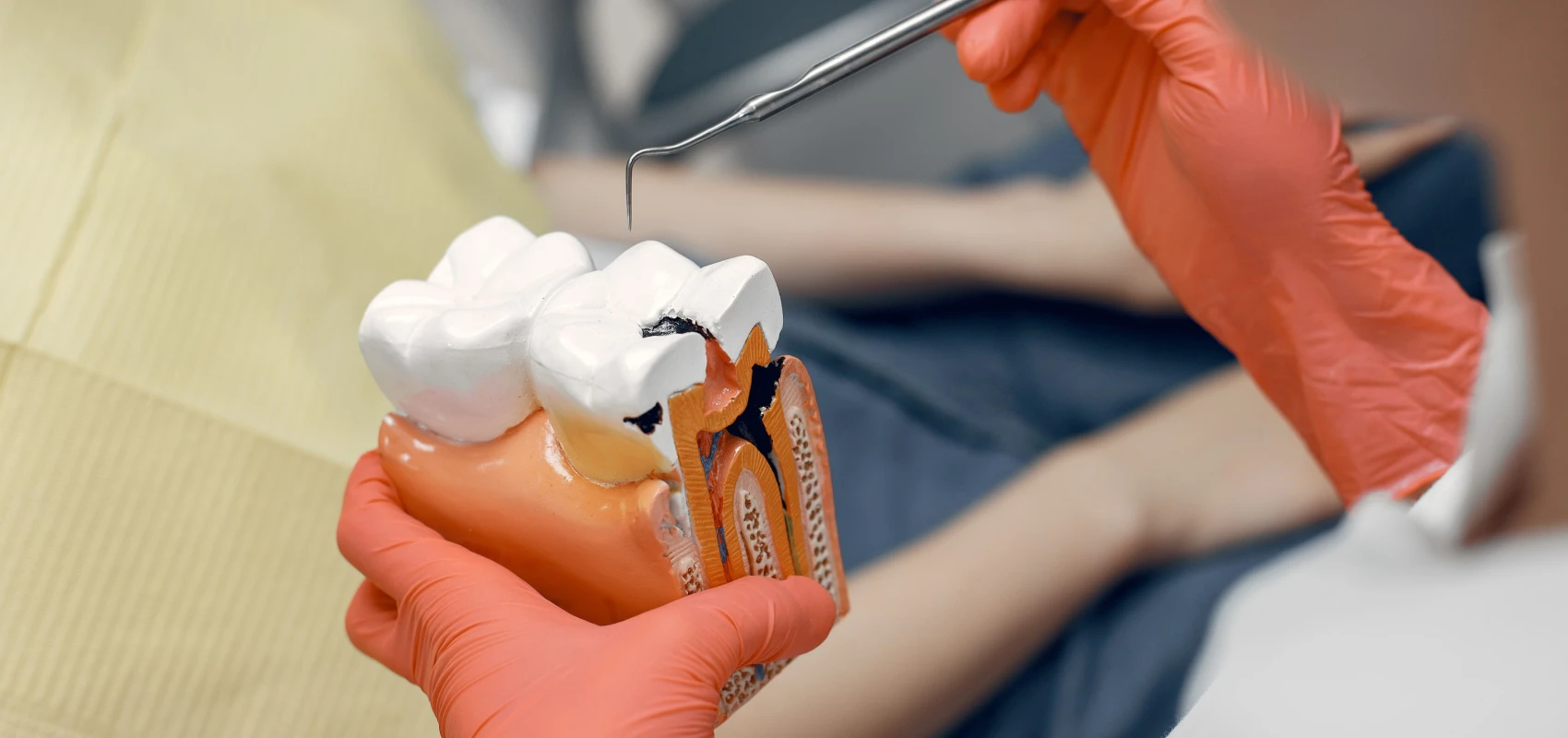 traitements dentaires gencives Soins des caries Dr Ludovic Zeitoun - Chirurgien-dentiste à L’Isle-Adam